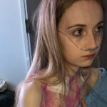 A Sra. Holland foi diagnosticada com ganglionopatia autonômica autoimune aos 18 anos.