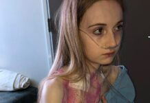 Annaliese Holland: ‘Falar sobre morte e escolhas não deveria ser tabu’ A Sra. Holland foi diagnosticada com ganglionopatia autonômica autoimune aos 18 anos.