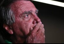 Qual a causa das crises de soluços do ex presidente Bolsonaro?